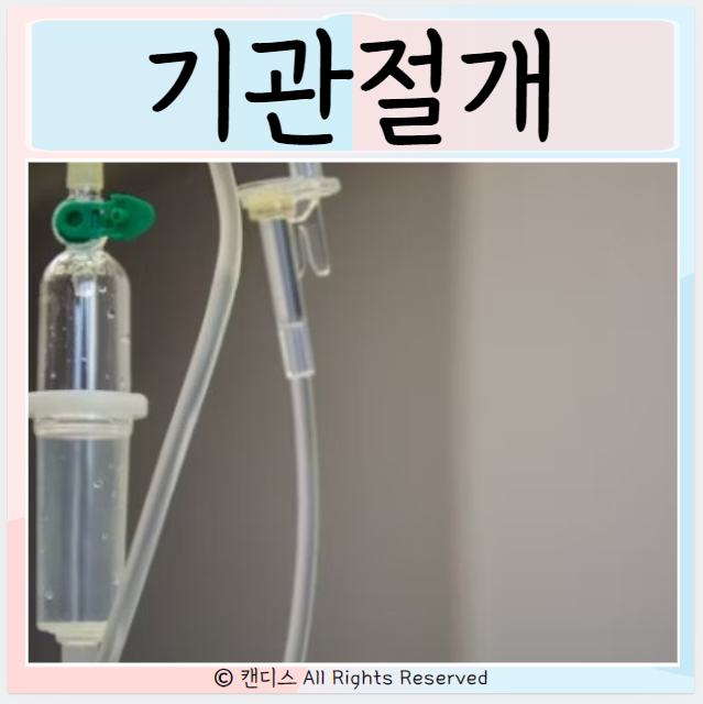  기관절개 종류 기관삽관 과정 장점 과 주의사항
