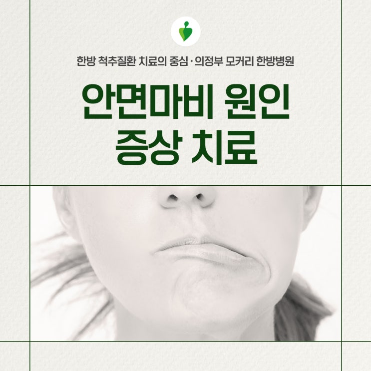  동두천 의정부한방병원 안면마비 원인 증상 치료