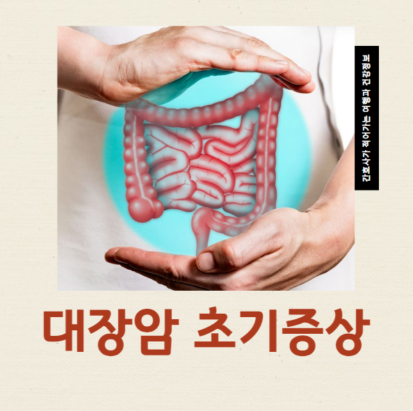  대장암 초기증상 5가지 1기 2기 생존율 조기발견과 진단