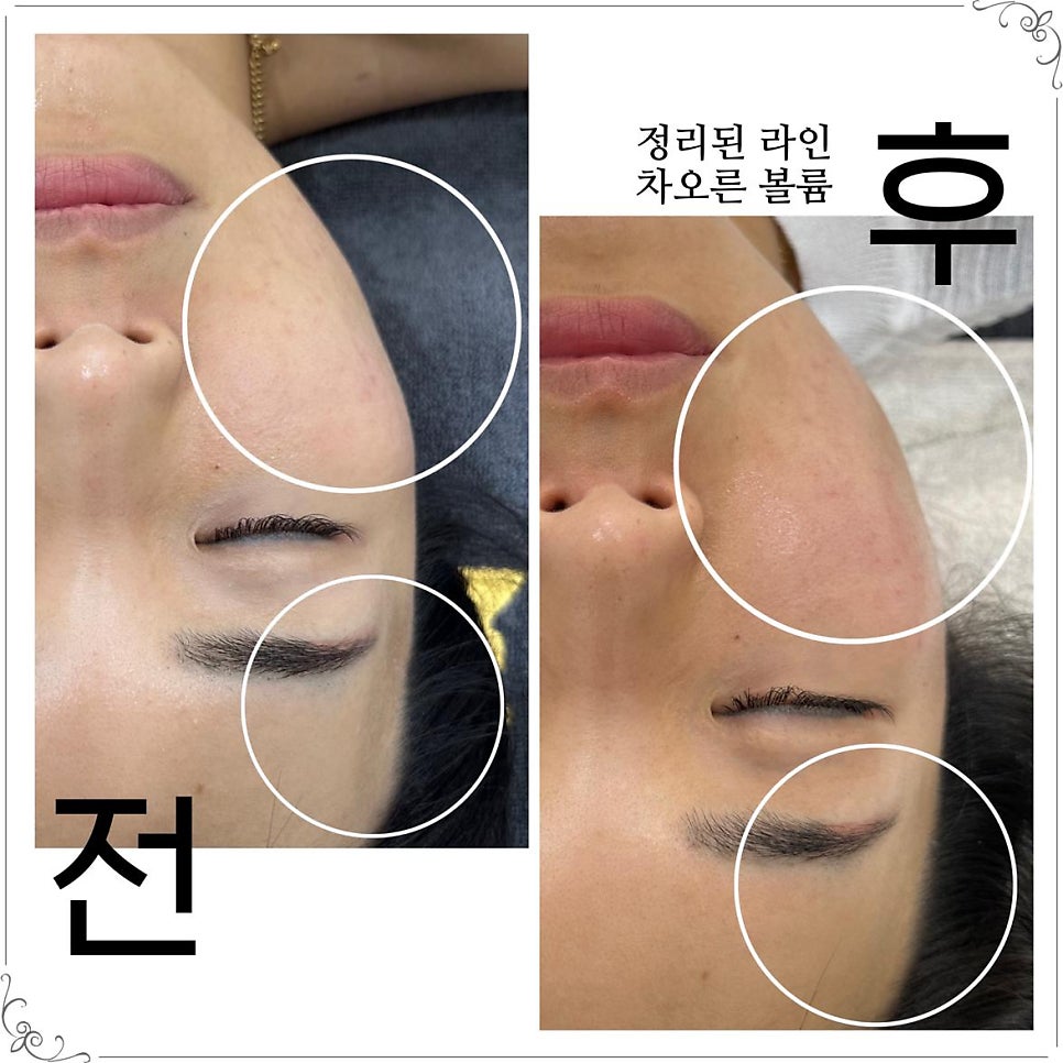 더예쁨 사진 2