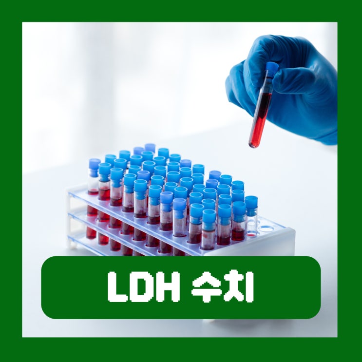  LDH 수치 높으면 낮으면 생기는 증상 간기능 검사 정상수치