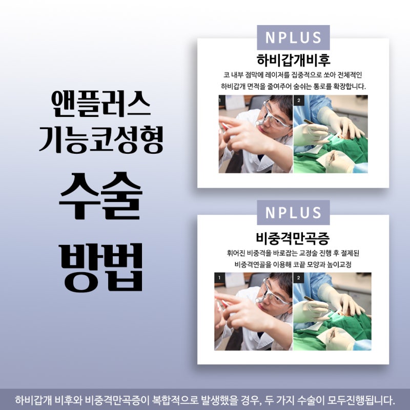 기능코성형 가격요점 정리