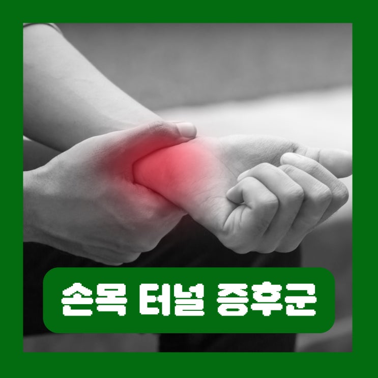  손목 터널 증후군 원인 증상 자가진단 테스트 통증 검사 수술 치료