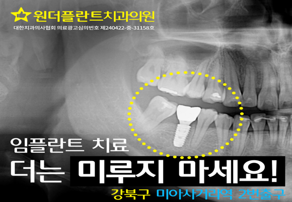  서울대 치대 출신 대표원장이 직접 시술하는 오스템임플란트 특별 할인 이벤트