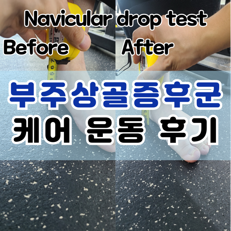  동래 헬스장 부주상골증후군 통증케어 PT 운동 후기