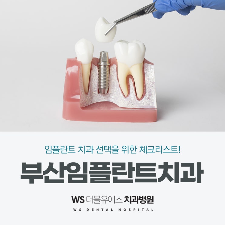  부산임플란트잘하는곳 고려사항은?