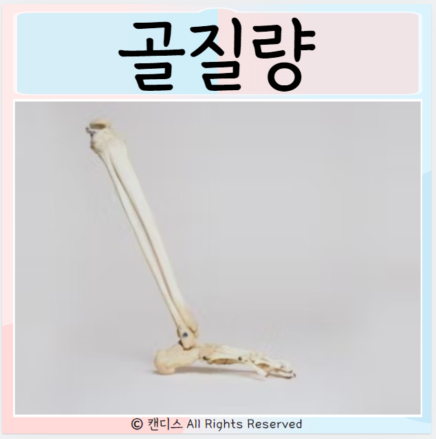  골질량 골밀도 측정 방법 높이는법