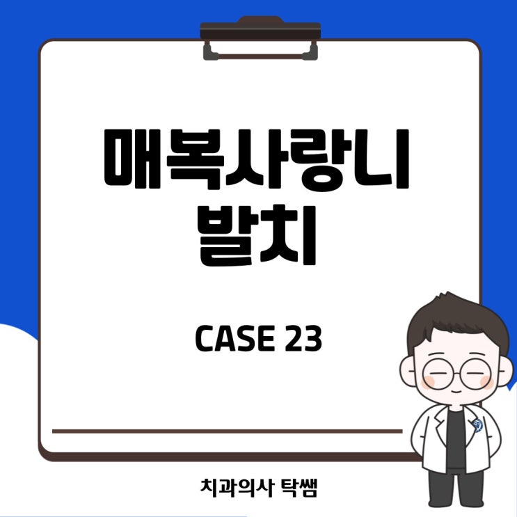  [탁쌤 CASE 23] 매복 사랑니 발치, 발치 후 주의사항