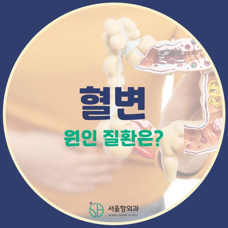  혈변 증상이 있다면 이 질환을 의심해보세요!