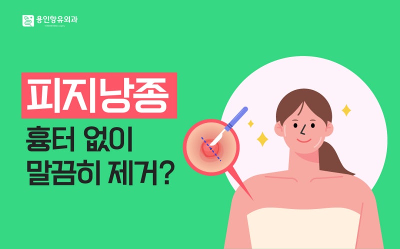 평택피지낭종 흉터 없이 말끔히 제거하고 싶다면?