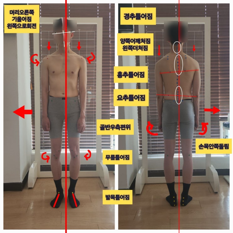  [부산 동래 사직동 체형분석 사례소개] 체형교정의 시작은 자세한 체형분석에서부터