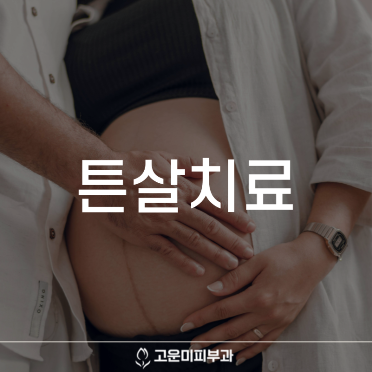  대구반월당튼살치료 고운미 피부과의 치료와 케어로 개선할 수 있습니다
