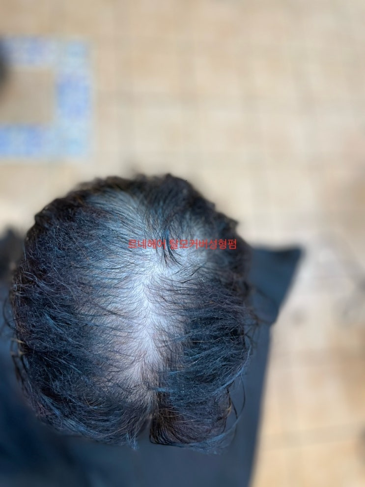  부산탈모커버펌으로 여성탈모 당신은 무죄. 사상구 르네시떼미용실 ( 괘법감전주례구덕모라덕천김해명지녹산감만영도당감개금용원진해창원거제서면부전범일초량남포대연수영망미해운대연산낙민경남경북)