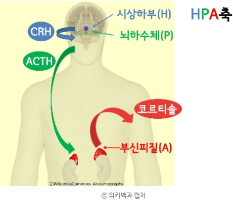  소아 청소년 아토피에 스테로이드 연고, 괜찮을까? 키 성장과의 연관성