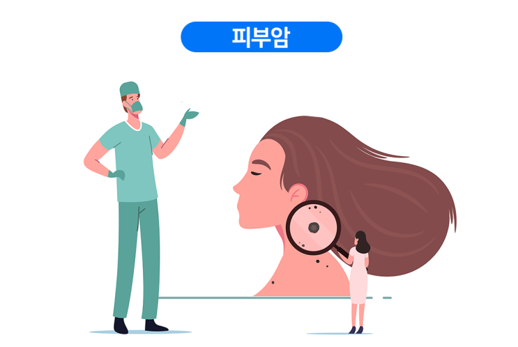 "피부암 경고 신호: 무시하면 큰일 납니다!"