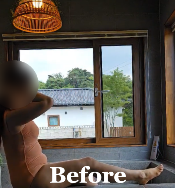  전신 람스 부작용? 람스 개미지옥에 빠짐