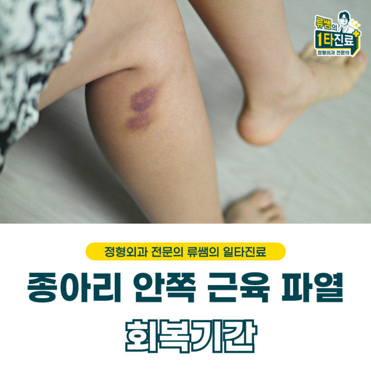  종아리 근육 파열/운동시작은 언제부터? (의사작성)