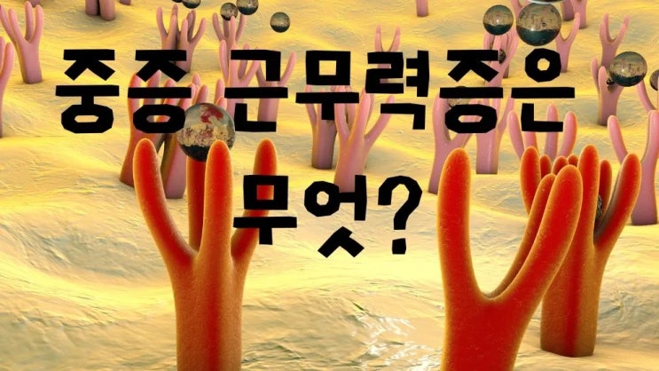  중증 근무력증 근육피로 한쪽눈꺼풀 처짐 원인 증상 치료