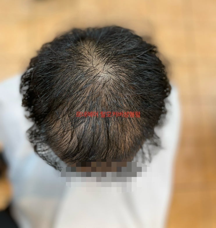  휑한 머리 탈모 펌으로 결혼 준비 끝 사랑해요 르네시떼미용실 [ 부산김해거제기장울산양산경남경북전남전북충남충북경기대구강원서울울릉제주]