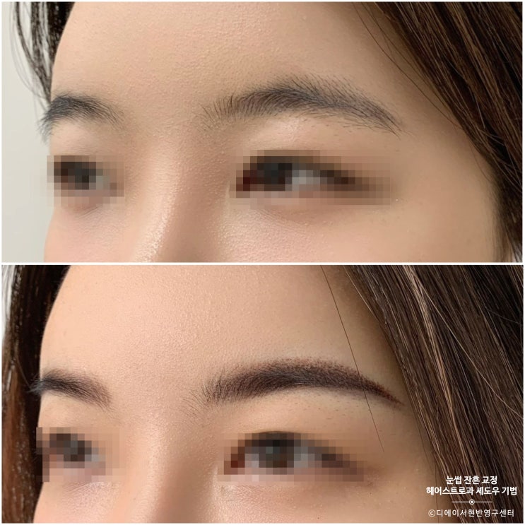  분당 눈썹 문신 푸른색으로 남은 눈썹 커버업 교정 시술