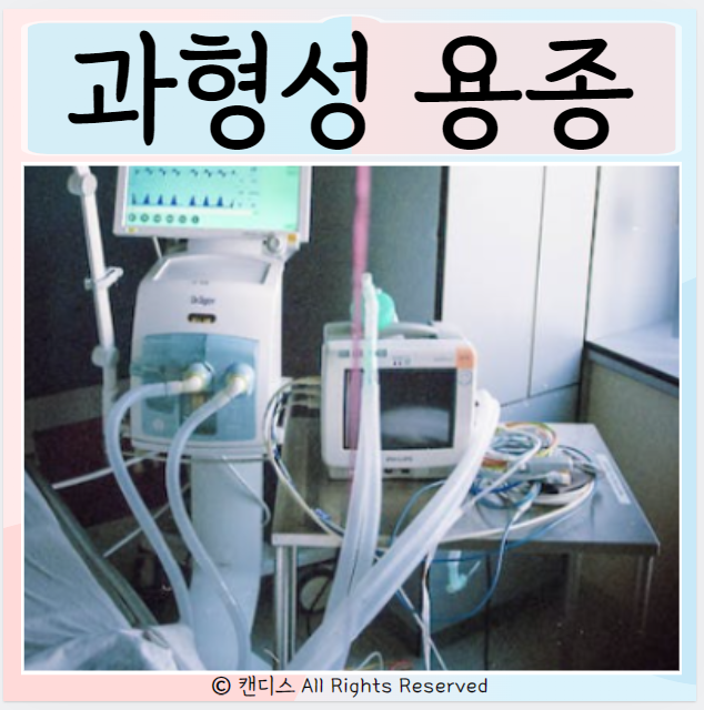  과형성 용종 증상 진단 증상 치료