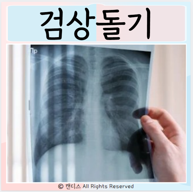  검상돌기 명치부근 통증 원인 담성