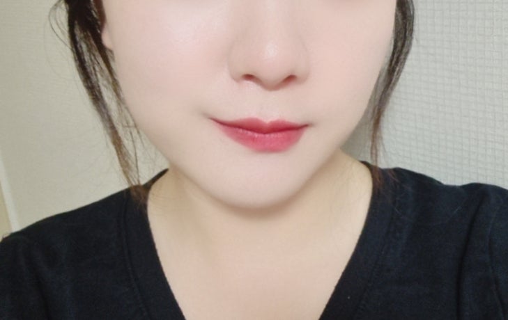  발산 마곡 듀얼토닝 효과, 만족 후기 (포토나,제네시스토닝)