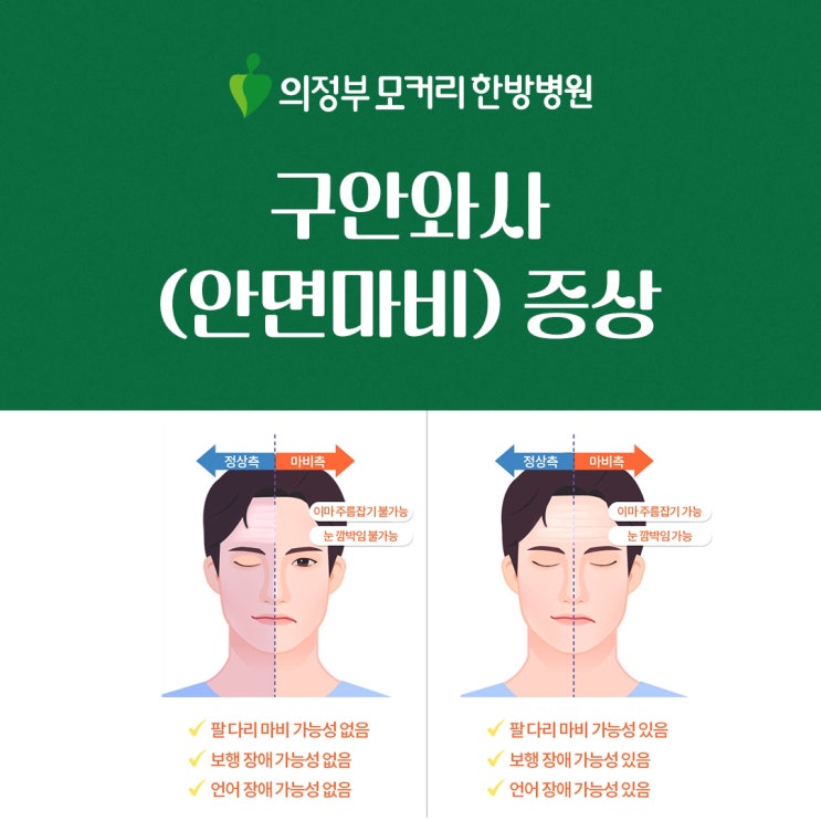  의정부 모커리한방병원 구안와사(안면마비) 증상