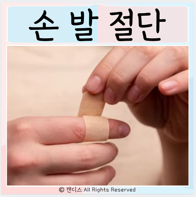  손가락 발가락 절단시 대처방법 잘린부위 보관 봉합수술
