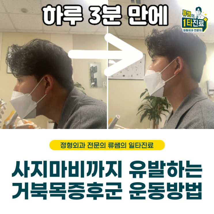  뒤통수 두통, 눈 통증 유발하는 거북목증후군 스트레칭법(의사작성)