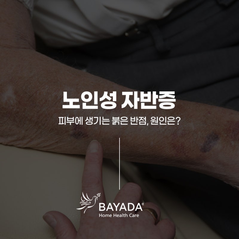 노인성 자반증 피부에 붉은 반점 생기는 원인
