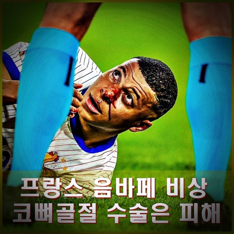 <b>음바페</b> <b>코뼈</b>골절 수술은 피해.... 안면 보호<b>마스크</b> 제작중.