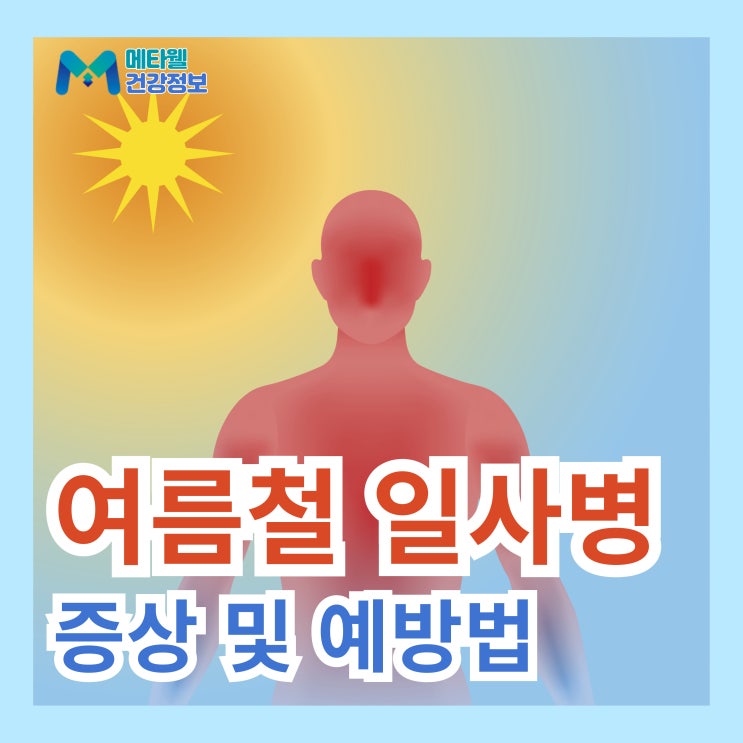  여름철 더위 주의 일사병 원인, 증상, 예방법