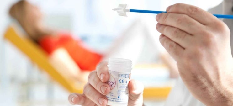  ThinPrep 액상체액세포검사 액상부인과세포진검사 액상흡인세포검사