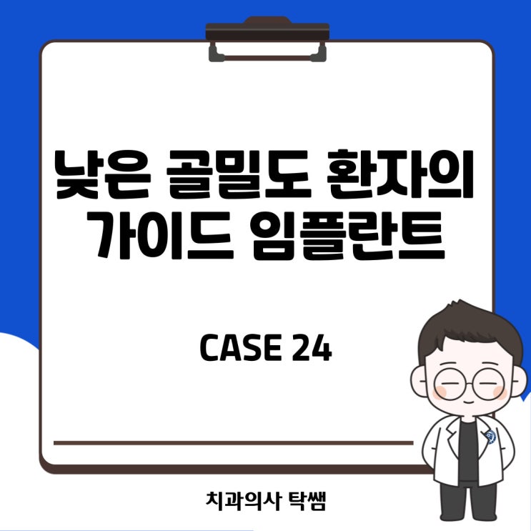  [탁쌤 CASE 24] 청주 낮은 골밀도 환자에서의 가이드 임플란트