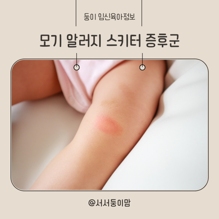  아기 모기 알러지 스키터증후군 연고 약 물집