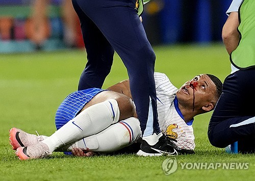 <b>음바페</b>, <b>코뼈</b> 골절로 네덜란드전 결장 확정