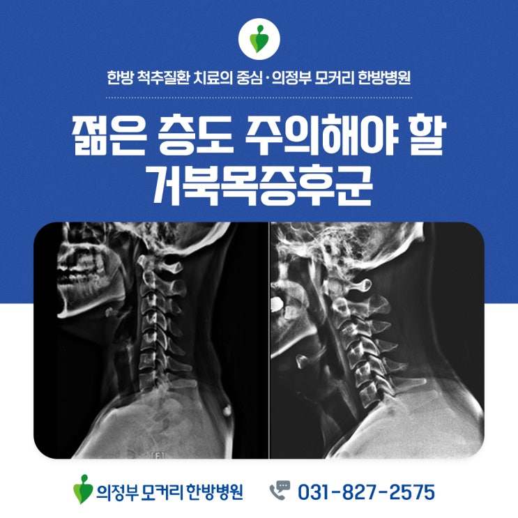  젊은 층도 주의해야 할 증상, 스마트폰 자세로 인한 '거북목증후군'