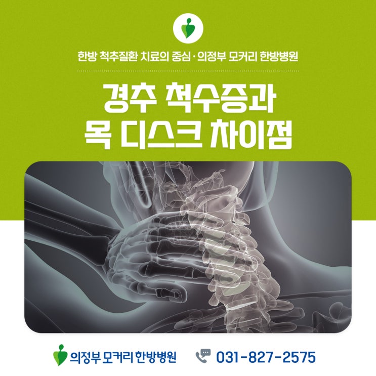  의정부 모커리한방병원 경추척수증과 목 디스크의 차이점