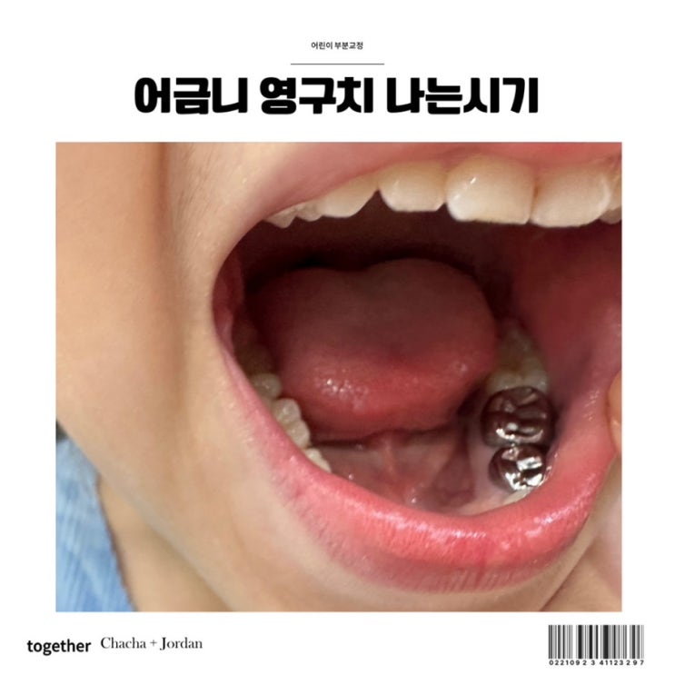  치과검진 후 어금니 부분교정 영구치 나는시기