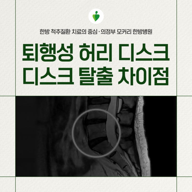  의정부 모커리한방병원 퇴행성 허리 디스크와 허리디스크 탈출의 차이점