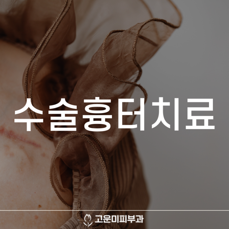  대구반월당흉터치료 수술 후 생긴 흉터를 최소화하는 흉터 진피 치환술