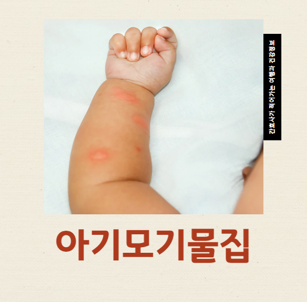  아기모기물집 알레르기 연고 버물리 어떻게 관리해야 할까?