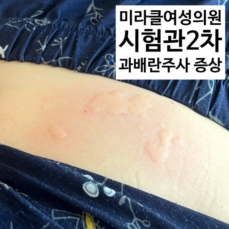  미라클여성의원 과배란주사 5일차 난포 체크 과배란 증상