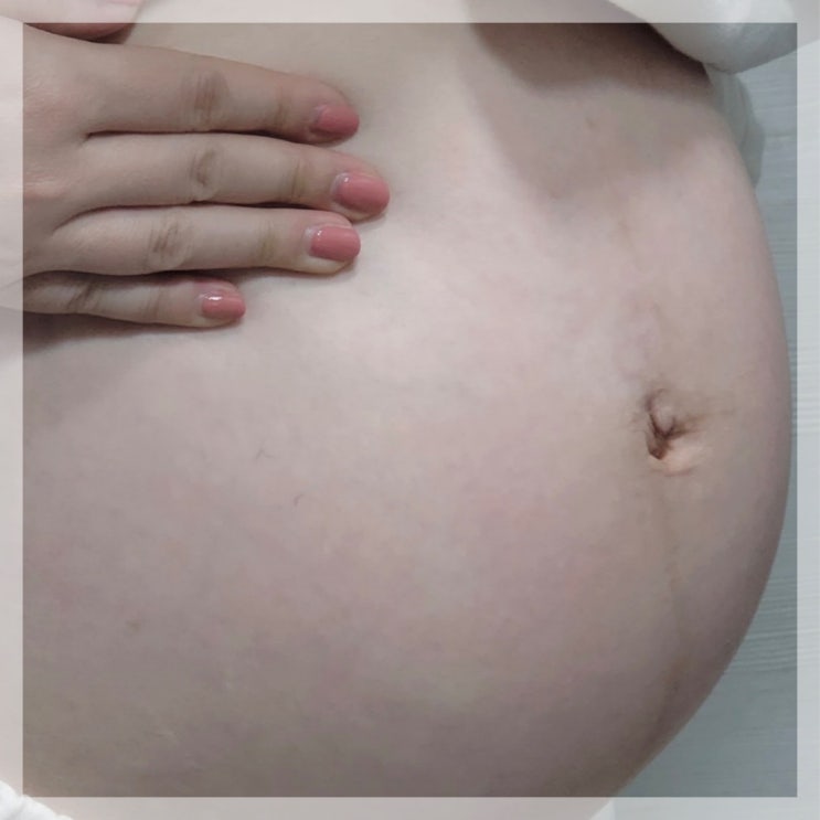  임신 주수별 신체변화 및 증상, 배크기 몸무게 검사항목