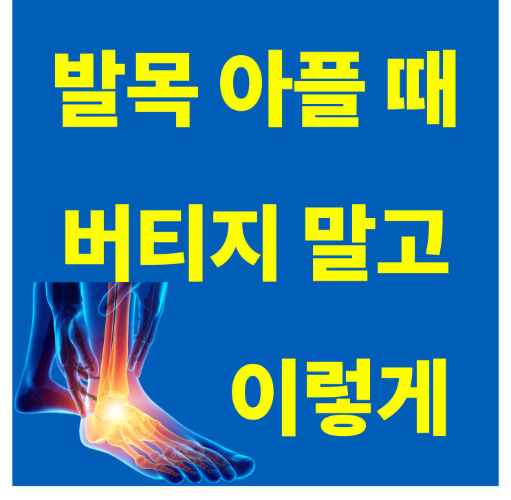  강동 헬스장ㅣ발목이 자주 삔다면? 딱! 3가지만 기억하세요.