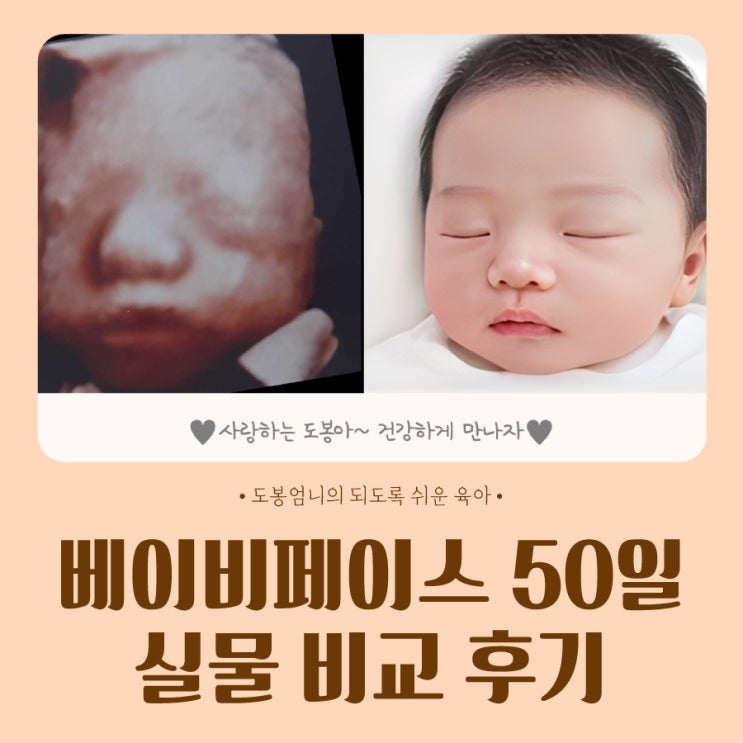  베이비페이스 생후 50일 실물 비교 싱크로율 후기 27주 입체초음파 시기