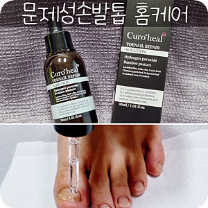 큐로힐 토네일 발톱무좀 관리中
