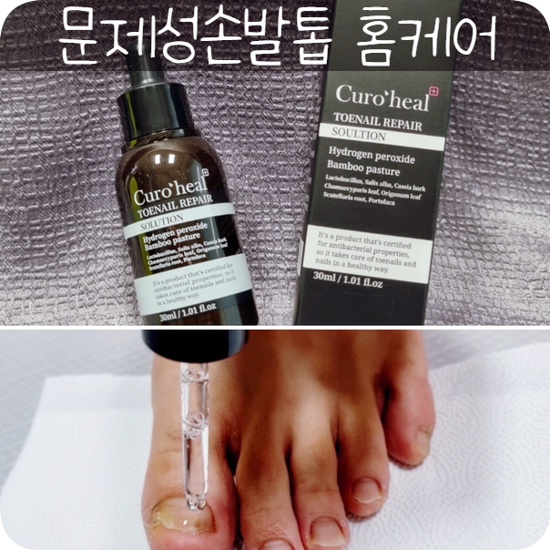 큐로힐 토네일 발톱무좀 관리中