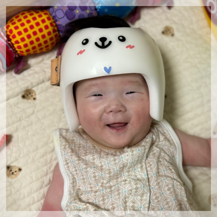  하니헬멧 동탄센터 사두증 두상 교정모자 맞춤제작 헬멧 착용시간 세척 관리 착용방법